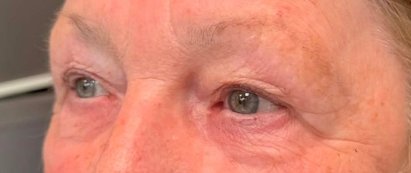 SPMU eyebrows in ellesmere port before image